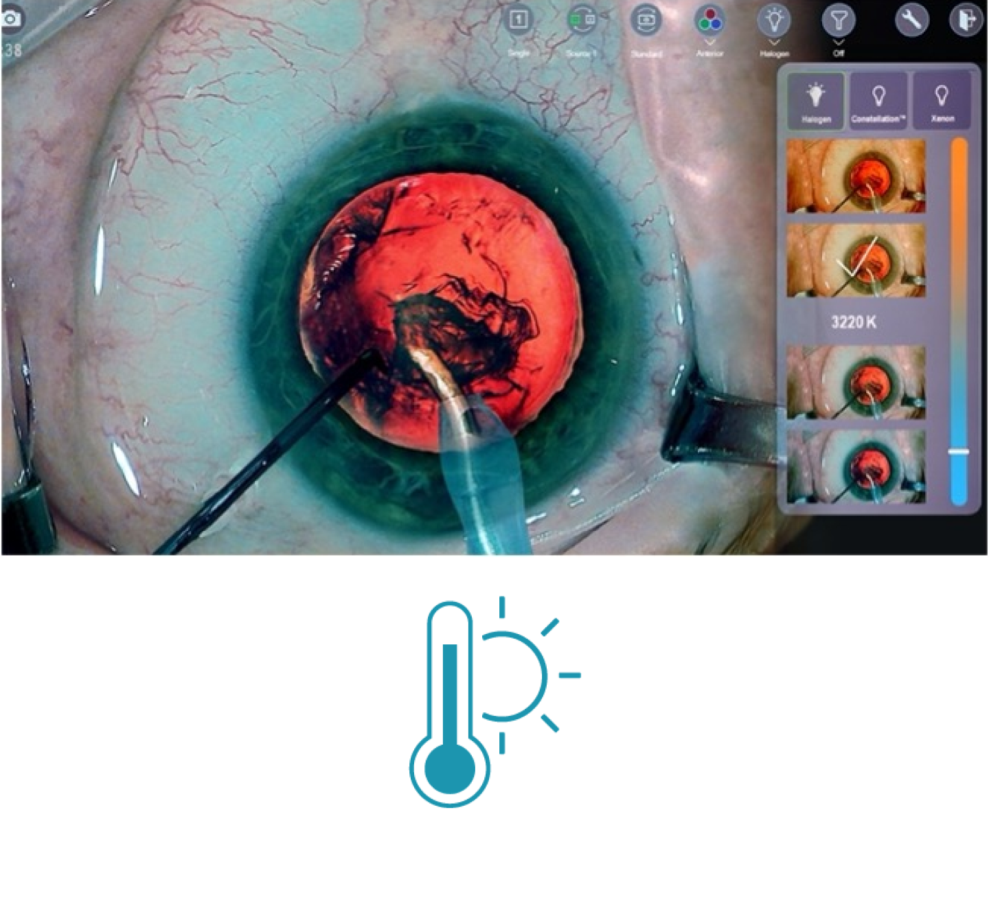 Een close-up van een oog tijdens een operatie met chirurgische instrumenten op het scherm Miniaturen aan de rechterkant van het scherm tonen de verschillende lichttemperatuurfilters die beschikbaar zijn met het NGENUITY 3D Visualization System. Een blauw pictogram met een thermometer en de zon erachter.