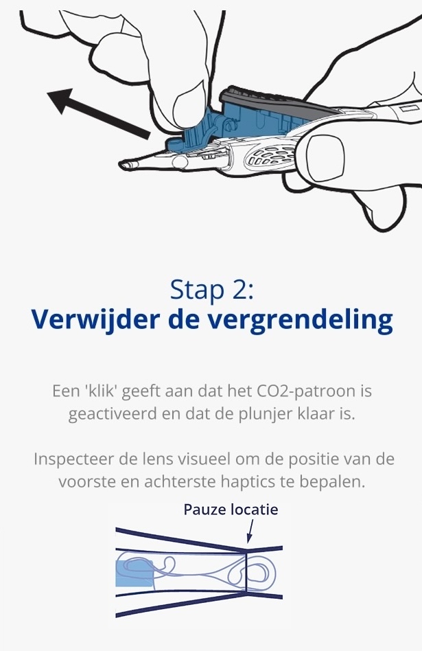 Een illustratie van een hand die het AutonoMe Delivery System vasthoudt. Een zwarte pijl wijst van de cartridge van het apparaat weg om een trekkende beweging aan te geven. Een illustratie van de plunjer/cartridge van het AutonoMe Delivery System. Een donkerblauwe pijl wijst naar de gevouwen IOL in de AutonoMe cartridge met de tekst 'Pauze Locatie.'