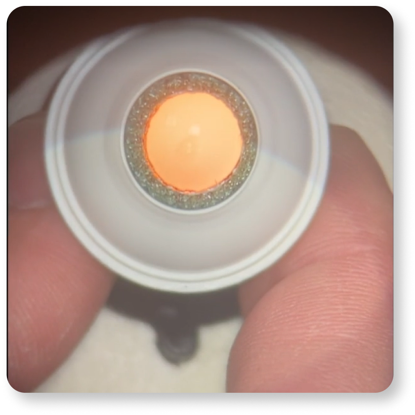 LuxOR® Revalia™ Ophthalmic Microscope Alcon Professional