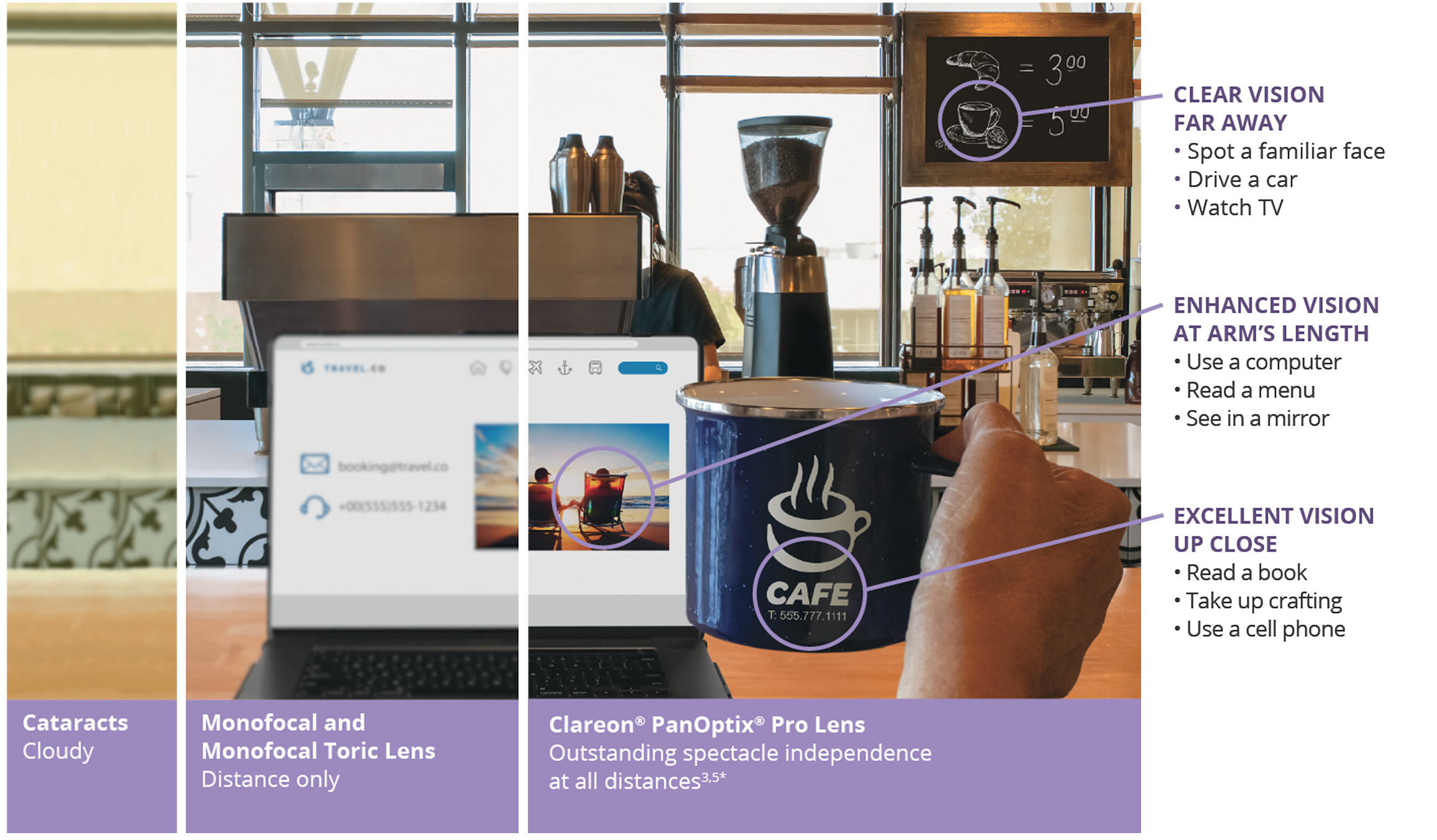Comparison image showing vision with cataracts, monofocal lens, and Clareon PanOptix Pro lens. Cataracts view is cloudy. Monofocal lens shows clear distance but blurred near and intermediate vision. Clareon PanOptix Pro lens shows clear vision at all distances: far away for spotting faces, driving, and watching TV; at arm’s length for computer use, reading menus, and mirrors; and up close for reading, crafting, or using a phone.