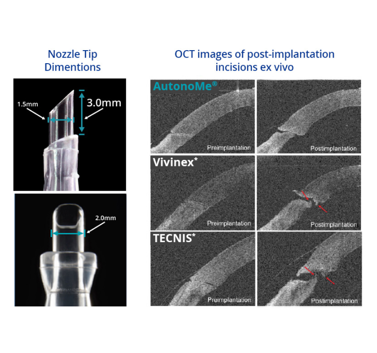Two related images beside each other. The first image is a close-up of the AutonoMe nozzle tip, with text indicating that the length of the tip is 3.0mm, and diameter of the tip is 2.0mm. Blue text at the top of this image reads “Nozzle Tip Dimensions.”    The second image is of the pre- and post- implantation process for AutonoMe, Vivinex, and Tecnis. Blue text at the top of this image reads “OCT images of post-implantation incisions ex vivo.” Red arrows on top of the Vivinex and Tecnis images point to membrane tearing post implantation ex vivo.
