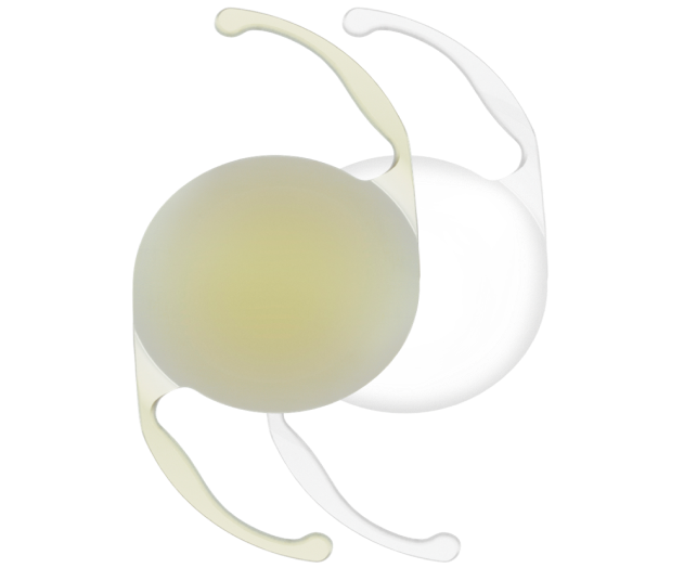 3-dimensional image of a yellow AcrySof IQ Monofocal IOLs and a clear AcrySof IQ Monofocal IOLs side-by-side.