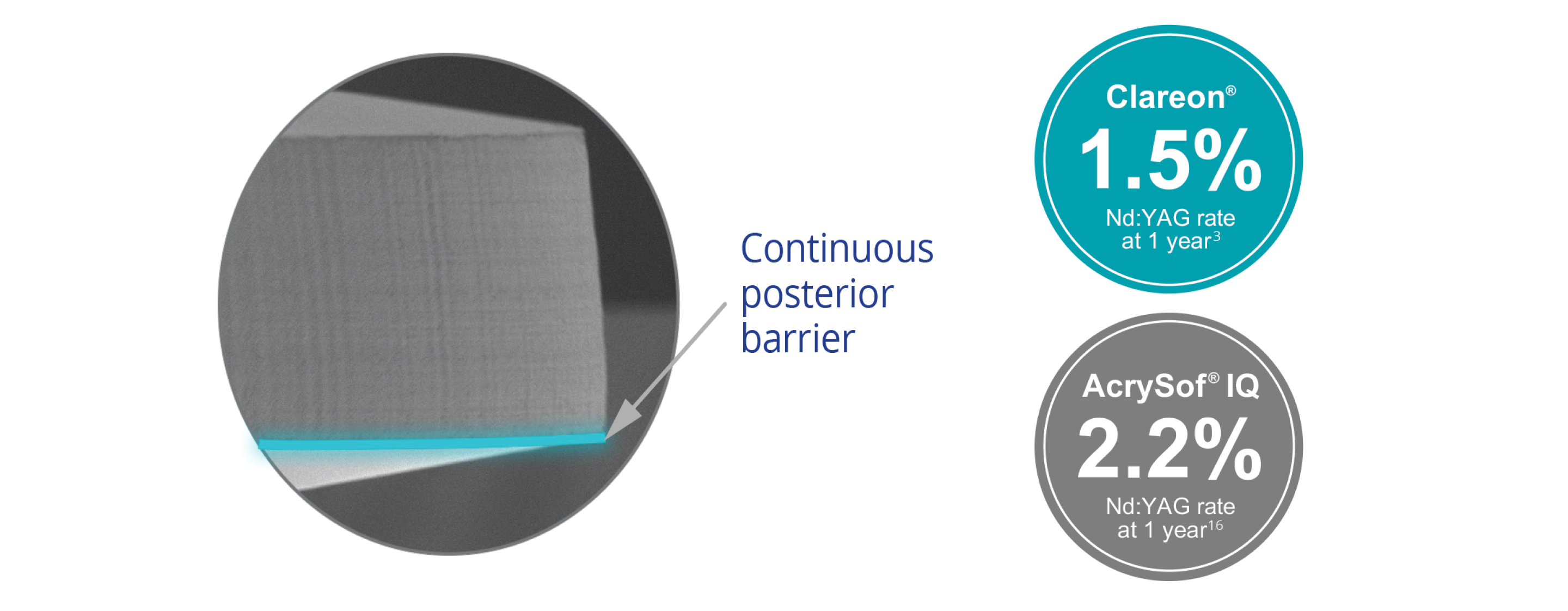 A circular visual of a microscopic image of the Clareon IOL with a teal-coloured line highlighting the continuous posterior barrier.  Two circular callouts also appear. The first callout over a teal-coloured background states that the Clareon IOL achieves an Nd:YAG rate of 1.5% at 1 year. The second callout, over a grey background, states that the AcrySof IQ IOL achieves an Nd:YAG rate of 2.2% at 1 year.