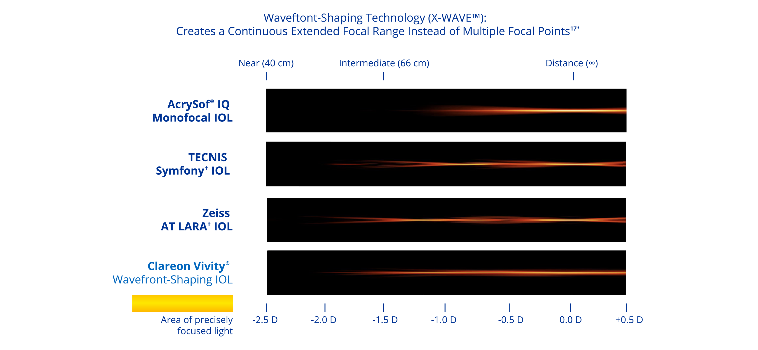 A graphic illustrating the range of vision with four different IOLs. The AcrySof® IQ monofocal IOL provides distance vision. The Symfony IOL provides distance, intermediate and near vision. The AT LARA IOL provides vision at distance and two intermediate focal points. The AcrySof IQ Vivity® IOL provides a continuous range of vision from distance to functional near.