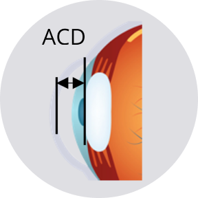 Cross-section of the eye with anterior chamber depth and lens position