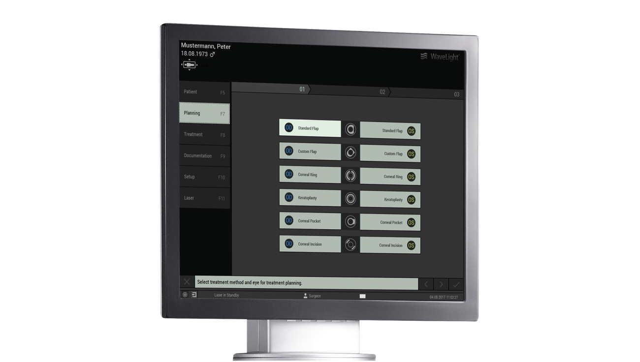 Monitor image with Wavelight® FS200 Femtosecond Laser interface