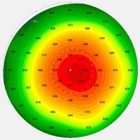 Pachymetry image