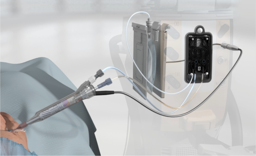 Een afbeelding van het CENTURION® Vision System met plustekenknoppen die de irrigatiedruksensor, het ACTIVE SENTRY® handstuk, de Active Fluidics™ technologie en de QuickValve™ technologie benadrukken.  
