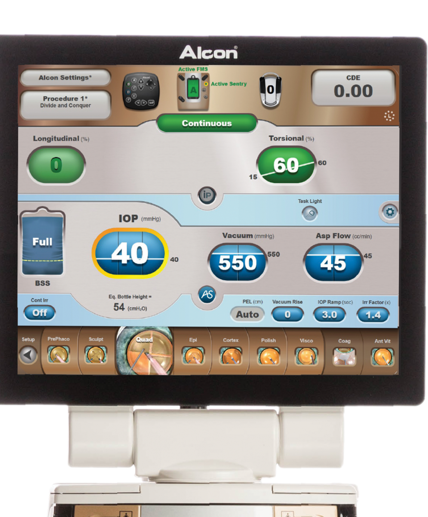 Een afbeelding van de grafische gebruikersinterface van het CENTURION Vision System.  