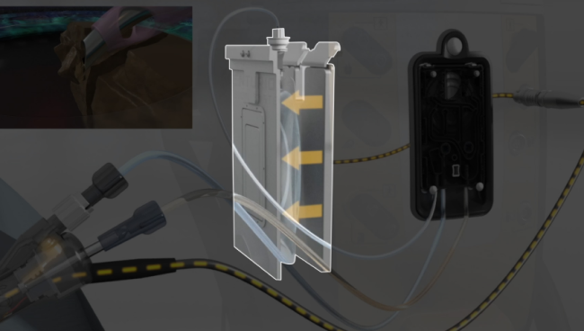 Een geanimeerde afbeelding van het CENTURION Vision System en het ACTIVE SENTRY handstuk naast een geopereerde patiënt. Gele pijlen markeren de compressieplaten die de druk op de zak met steriele BSS-oplossing aanpassen.  