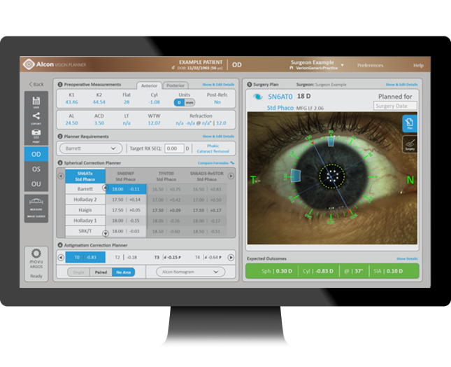 Een afbeelding van een computerscherm waarop de gebruikersinterface van de Alcon Vision Planner wordt weergegeven, met meetgegevens aan de linkerkant en een afbeelding van het oog van de patiënt aan de rechterkant.