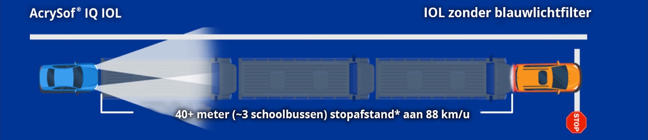 Afbeelding van een auto met het label AcrySof IQ IOL en een auto met het label Non-blue Light Filtering IOL. De tekst op het scherm luidt: "40+ meter (~3 schoolbussen) stopafstand bij 88 km/u." 