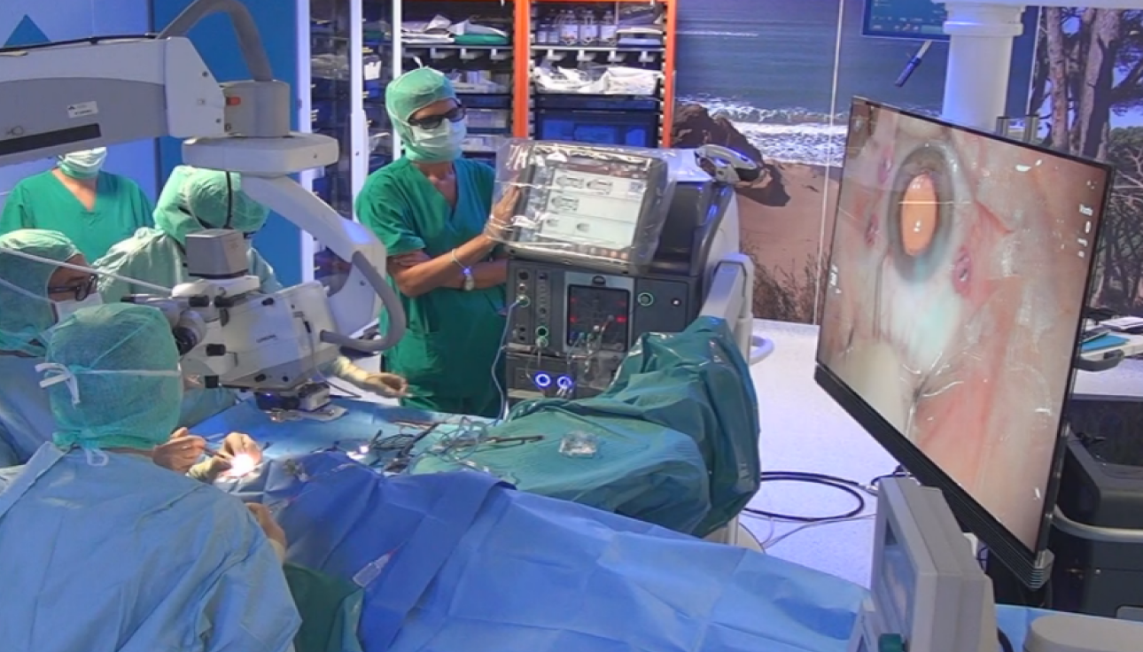 Surgeons performing eye surgery while looking at the image of the eye on a screen.