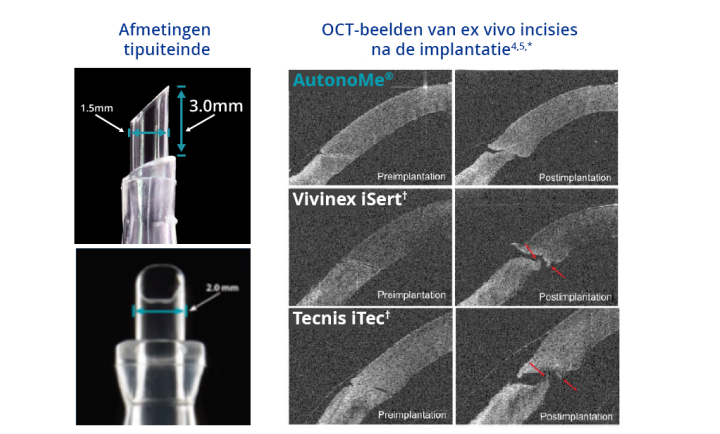 Twee gerelateerde afbeeldingen naast elkaar. De eerste afbeelding is een close-up van de AutonoMe nozzle tip, met tekst die aangeeft dat de lengte van de tip 3,0 mm is en de diameter van de tip 2,0 mm. Blauwe tekst bovenaan deze afbeelding leest "Nozzle Tip Dimensions."  De tweede afbeelding toont het pre- en post-implantatieproces voor AutonoMe, Vivinex en Tecnis. Blauwe tekst bovenaan deze afbeelding leest "OCT-afbeeldingen van post-implantatie incisies ex vivo." Rode pijlen boven de Vivinex- en Tecnis-afbeeldingen wijzen naar membraanscheuren na de implantatie ex vivo.