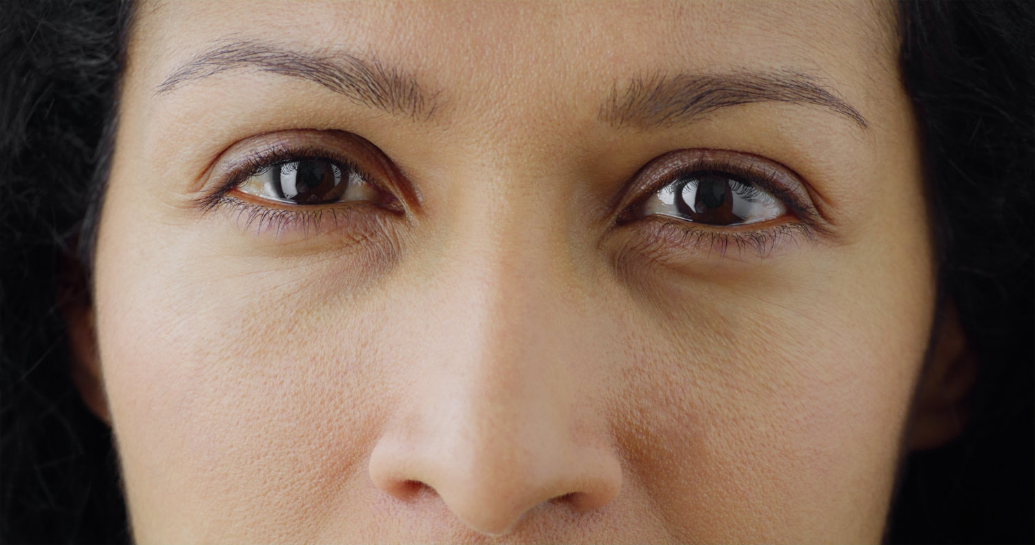close-up of a woman with dry eye