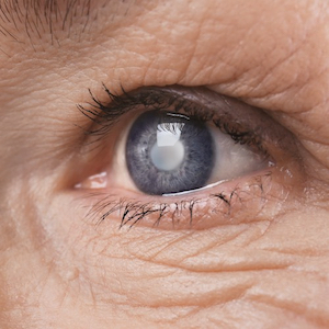 Zbliżenie niebieskiego oka starszej osoby, odbijającego światło podczas badania