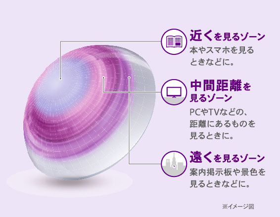 アルコン独自技術