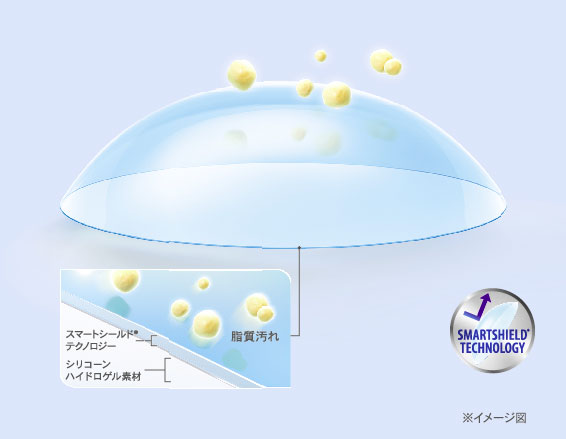 アルコン独自技術