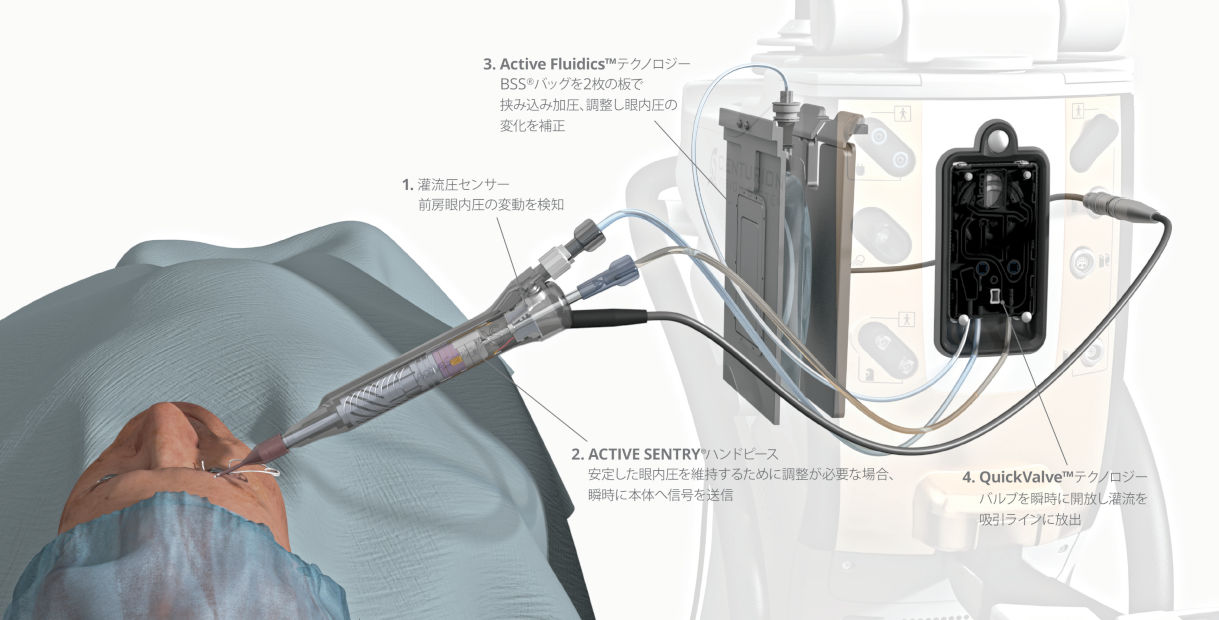 図1：ACTIVE SENTRYによる最新の灌流システムの仕組み