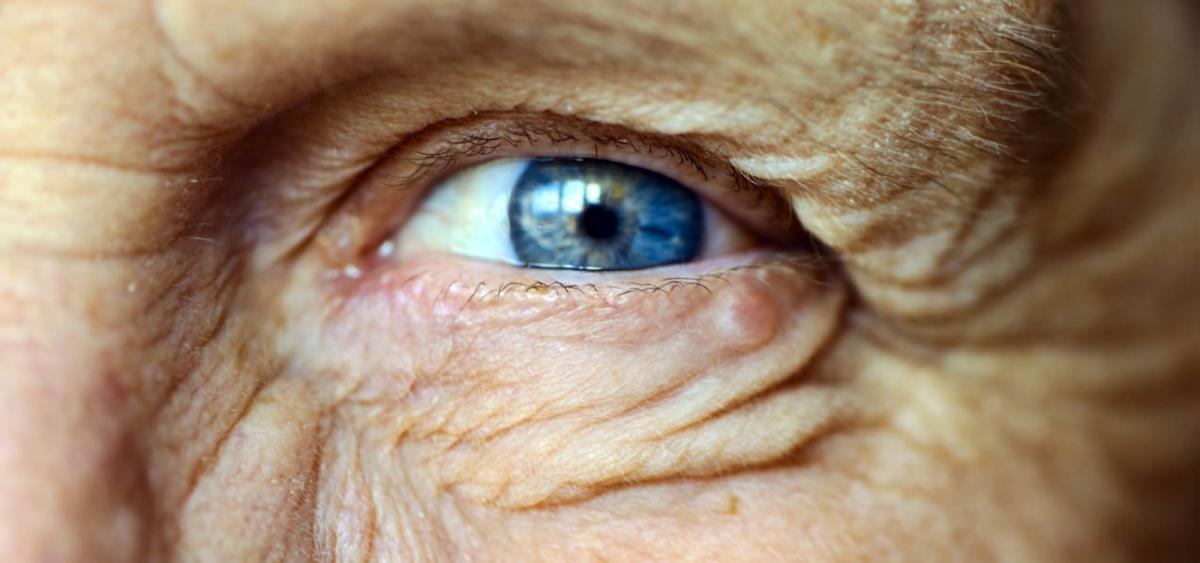 Close up on an older person's eye