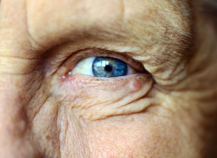 Close up on an older person's eye