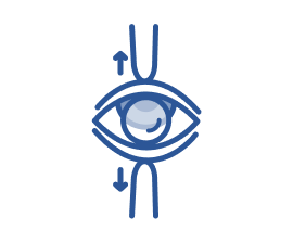 Illustration of an open eye with arrows showing how to lift the upper eyelid and pull down the lower lid, with a contact lens positioned on the eye